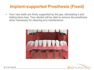 Implant-supported Prosthesis (Fixed) Your new teeth are firmly supported by the jaw, stimulating it and halting bone loss. Your dentist will be able to remove the prosthesis when necessary for cleaning and maintenance. 