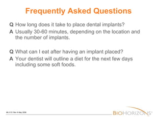 Frequently Asked Questions Q How long does it take to place dental implants? A   Usually 30-60 minutes, depending on the location and the number of implants. Q What can I eat after having an implant placed? A Your dentist will outline a diet for the next few days including some soft foods. 