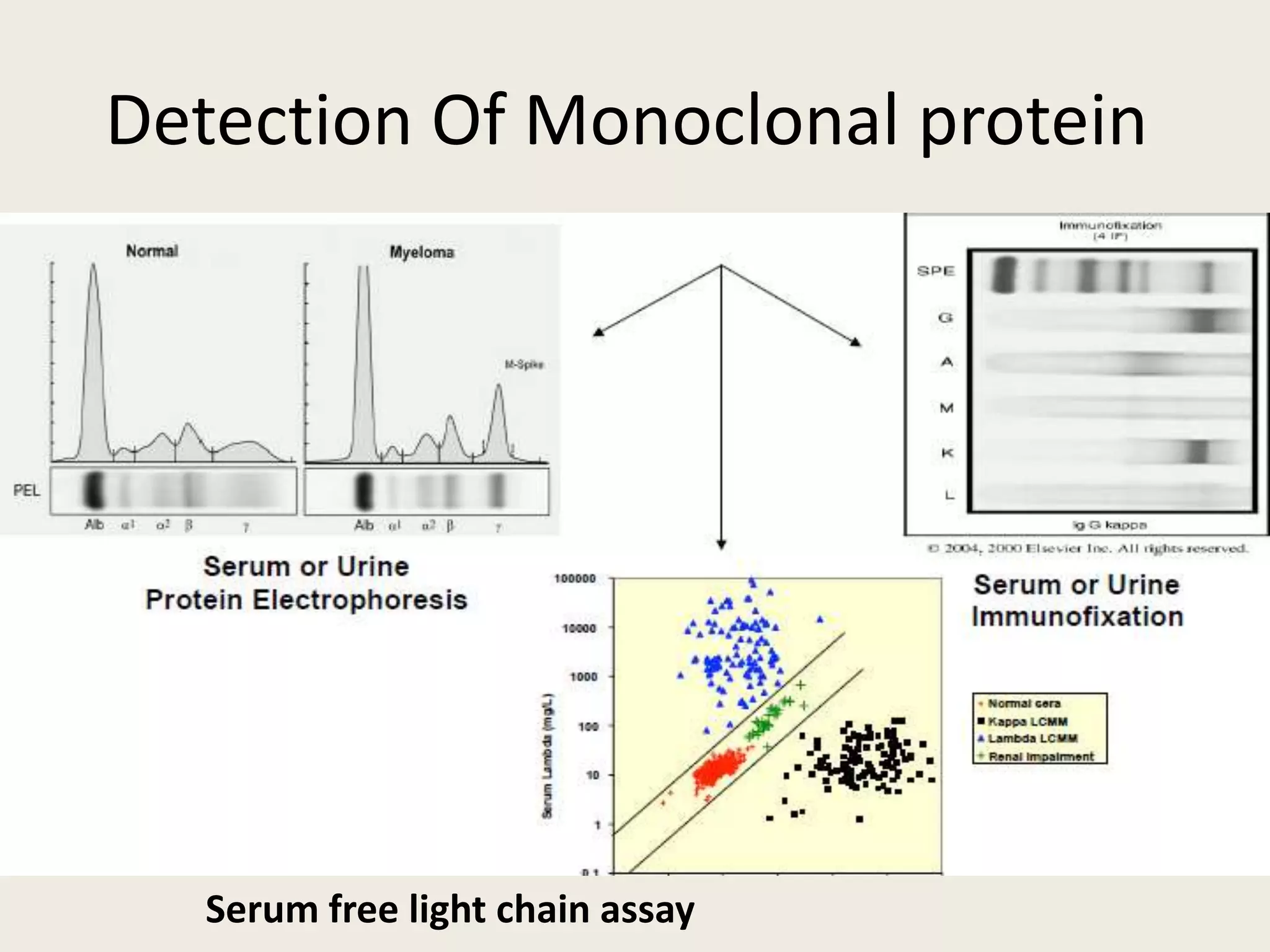 Detection Of Monoclonal protein
Serum free light chain assay
 