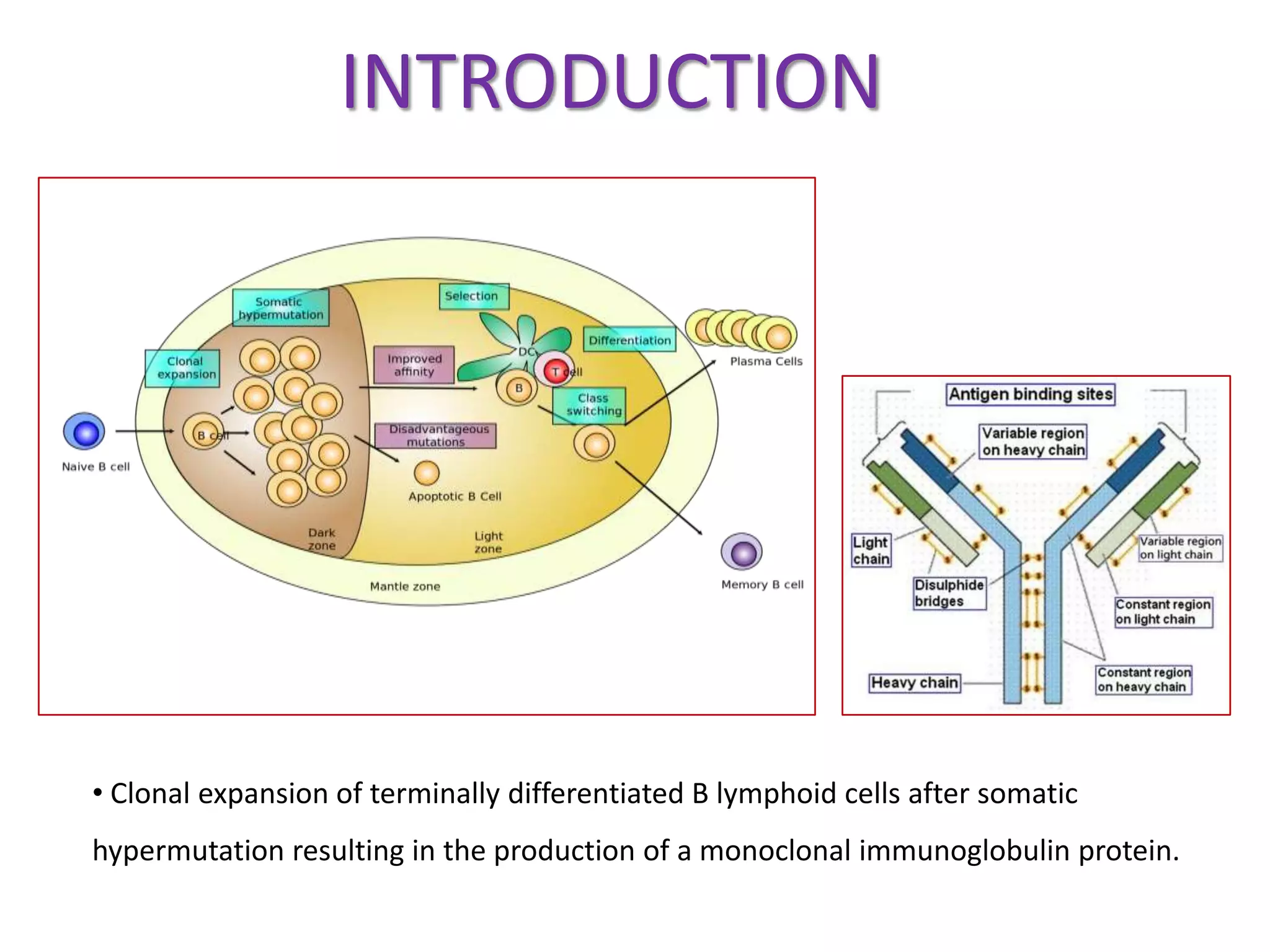 Multiple Myeloma | PPTX
