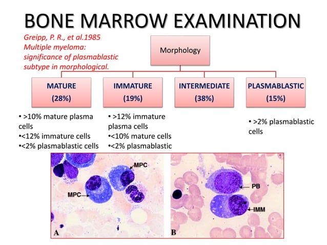Multiple Myeloma Blood Test Explained – JSLDLN