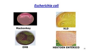 Escherichia coli
23
XLD
Mackonkey
EMB HEKTOEN ENTÉRICO
 