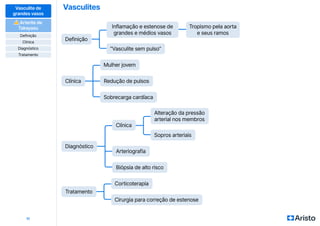 Vasculites
11
Definição
Tratamento
Clínica
Diagnóstico
Inflamação e estenose de
grandes e médios vasos
Corticoterapia
Alteração da pressão
arterial nos membros
Mulher jovem
Clínica
“Vasculite sem pulso”
Cirurgia para correção de estenose
Sopros arteriais
Redução de pulsos
Arteriografia
Tropismo pela aorta
e seus ramos
Sobrecarga cardíaca
Biópsia de alto risco
Vasculite de
grandes vasos
⚠
⚠ Arterite de
Takayasu
Definição
Diagnóstico
Clínica
Tratamento
 