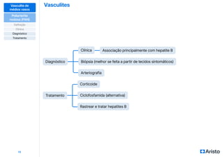 Vasculites
13
Vasculite de
médios vasos
Poliarterite
nodosa (PAN)
Definição
Diagnóstico
Clínica
Tratamento
Tratamento
Diagnóstico
Corticoide
Associação principalmente com hepatite B
Clínica
Ciclofosfamida (alternativa)
Rastrear e tratar hepatites B
Biópsia (melhor se feita a partir de tecidos sintomáticos)
Arteriografia
 