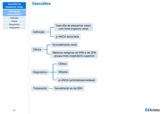 Vasculites
19
Clínica
Vasculite de pequenos vasos
com forte tropismo renal
Acometimento renal
Biópsia
Diagnóstico
Tratamento Semelhante ao de GPA
Definição
Clínica
p-ANCA (antimieloperoxidase)
p-ANCA associada
Mesmos estigmas de PAN e de GPA
(poupa trato respiratório superior)
Vasculite de
pequenos vasos
Poliangeíte
microscópica
Definição
Diagnóstico
Clínica
Tratamento
 