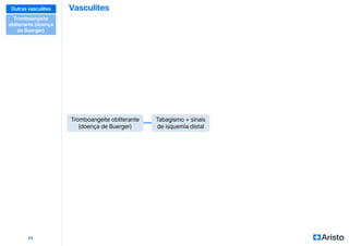 Vasculites
25
Tromboangeíte obliterante
(doença de Buerger)
Tabagismo + sinais
de isquemia distal
Outras vasculites
Tromboangeíte
obliterante (doença
de Buerger)
 