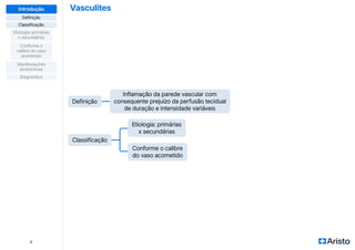 Vasculites
4
Definição
Classificação
Diagnóstico
Manifestações
sindrômicas
Etiologia: primárias
x secundárias
Conforme o
calibre do vaso
acometido
Introdução
Inflamação da parede vascular com
consequente prejuízo da perfusão tecidual
de duração e intensidade variáveis
Definição
Classificação
Etiologia: primárias
x secundárias
Conforme o calibre
do vaso acometido
 