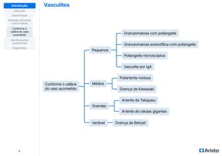 Vasculites
6
Definição
Classificação
Diagnóstico
Manifestações
sindrômicas
Etiologia: primárias
x secundárias
Conforme o
calibre do vaso
acometido
Introdução
Médios
Grandes
Poliarterite nodosa
Arterite de Takayasu
Granulomatose eosinofílica com poliangeíte
Poliangeíte microscópica
Granulomatose com poliangeíte
Pequenos
Variável Doença de Behçet
Conforme o calibre
do vaso acometido Doença de Kawasaki
Arterite de células gigantes
Vasculite por IgA
 