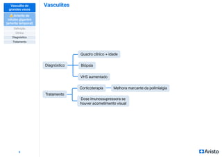 Vasculites
9
Vasculite de
grandes vasos
⚠
⚠ Arterite de
células gigantes
(arterite temporal)
Definição
Diagnóstico
Clínica
Tratamento
Biópsia
Melhora marcante da polimialgia
Quadro clínico + idade
Corticoterapia
VHS aumentado
Dose imunossupressora se
houver acometimento visual
Diagnóstico
Tratamento
 