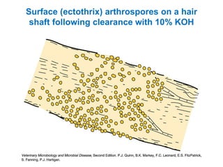 Surface (ectothrix) arthrospores on a hair
shaft following clearance with 10% KOH
 