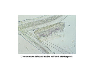 T. verrucosum: infected bovine hair with arthrospores
 