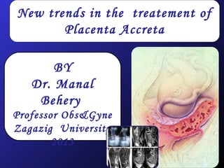 New trends inin treatement ofof
New trends the treatement
Placenta Accreta
Placenta Accreta
BY
Dr. Manal
Behery
Professor Obs&Gyne
Zagazig University
2013

 