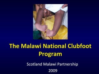 Scotland Malawi Partnership 2009 The Malawi National Clubfoot Program 