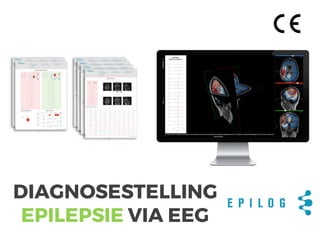 DIAGNOSESTELLING
EPILEPSIE VIA EEG
 