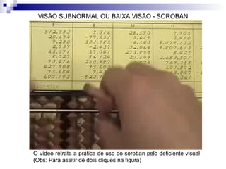VISÃO SUBNORMAL OU BAIXA VISÃO - SOROBAN O vídeo retrata a prática de uso do soroban pelo deficiente visual (Obs: Para assitir dê dois cliques na figura)  