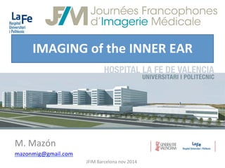 IMAGING	of	the	INNER	EAR	
M.	Mazón	
mazonmig@gmail.com	
JFIM	Barcelona	nov	2014	
 