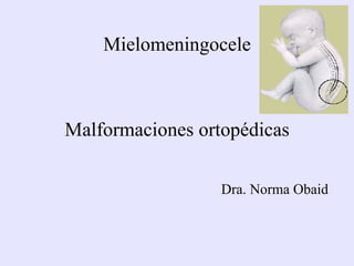 Mielomeningocele Malformaciones ortopédicas Dra. Norma Obaid 