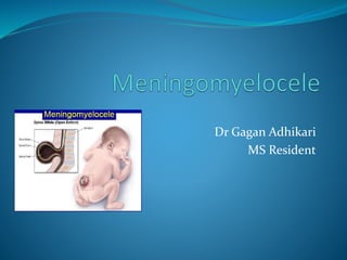Dr Gagan Adhikari
MS Resident
 