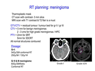 RT planning: meningioma
GTV/CTV = residual tumour / tumour bed for gr II / gr III
CTV = 5 mm for benign meningiomas
2 - 3 cms for high grade meningiomas / HPC
PTV = 2mm for SRT
5mm for 3DCRT
All normal structures contoured
Dosage:
Gr-I:
54Gy/30# conformal RT
25Gy/5# / 13Gy/1#
Gr II & III meningioma:
60Gy/30#/6wks
Conformal RT
Grade I Grade II/III
Tharmoplastic mask
CT scan with contrast- 3 mm slice
MRI scan with T1 contrast & T2 flair is a must
 