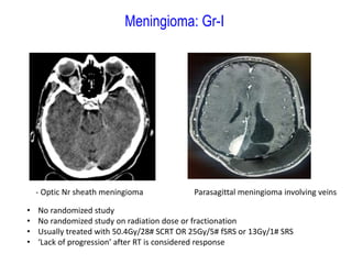 Meningioma: Gr-I
- Optic Nr sheath meningioma Parasagittal meningioma involving veins
• No randomized study
• No randomized study on radiation dose or fractionation
• Usually treated with 50.4Gy/28# SCRT OR 25Gy/5# fSRS or 13Gy/1# SRS
• ‘Lack of progression’ after RT is considered response
 