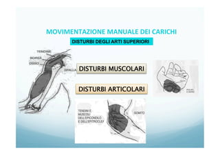 9
DISTURBI DEGLI ARTI SUPERIORI
DISTURBI MUSCOLARI
DISTURBI ARTICOLARI
MOVIMENTAZIONE	
  MANUALE	
  DEI	
  CARICHI	
  
 
