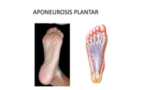 APONEUROSIS PLANTAR
 