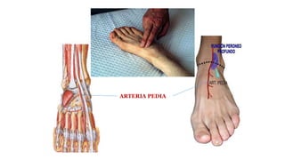 ARTERIA PEDIA
 