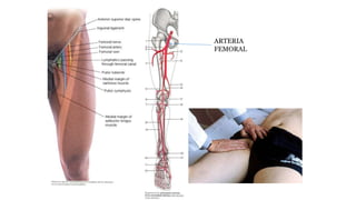ARTERIA
FEMORAL
 