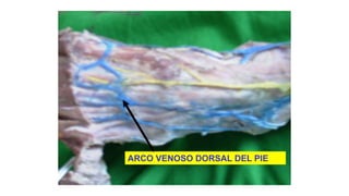 ARCO VENOSO DORSAL DEL PIE
 