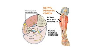 NERVIO
PERONEO
COMÚN
NERVIO
PERONEO
SUPERFICIAL
NERVIO
PERONEO
PROFUNDO
 