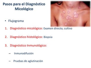 Pasos para el Diagnóstico
Micológico
• Flujograma
1. Diagnóstico micológico: Examen directo, cultivo
2. Diagnóstico histológico: Biopsia
3. Diagnóstico Inmunológico:
– Inmunodifusión
– Pruebas de aglutinación
 
