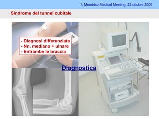 Sindrome del tunnel cubitale 1. Mendriso Medical Meeting, 22 ottobre 2009 Diagnostica - Diagnosi differenziata - Nn. mediano + ulnare - Entrambe le braccia 