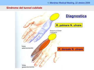 Sindrome del tunnel cubitale 1. Mendriso Medical Meeting, 22 ottobre 2009 Diagnostica R. palmare N. ulnare R. dorsale N. ulnare 