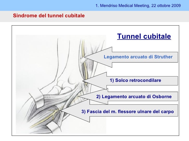 Esercizi Per Sindrome Del Tunnel Cubitale Tunnel cubitale