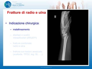 • Indicazione chirurgica:
– malallineamento
– diastasi e scalini
intraarticolari (ARUD!!!)
– fratture combinate
radio e ulna
– frattura con lesioni associate
(scafoide, TFCC, leg. SL, …)
Fratture di radio e ulna
 