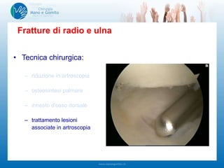 • Tecnica chirurgica:
– riduzione in artroscopia
– osteosintesi palmare
– innesto d'osso dorsale
– trattamento lesioni
associate in artroscopia
Fratture di radio e ulna
 