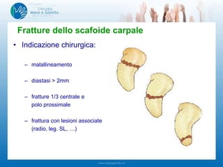 • Indicazione chirurgica:
– malallineamento
– diastasi > 2mm
– fratture 1/3 centrale e
polo prossimale
– frattura con lesioni associate
(radio, leg. SL, …)
Fratture dello scafoide carpale
 