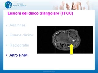 • Anamnesi
• Esame clinico
• Radiografie
• Artro RNM
Lesioni del disco triangolare (TFCC)
-Deformazioni
-Mobilità polso: pro-/supinazione
-Instabilità art. radio ulnare distale
-…
-Polso controlaterale!!!
-Gomito!!!
 
