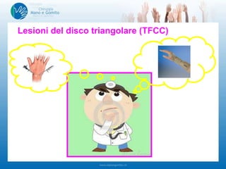 Lesioni del disco triangolare (TFCC)
 