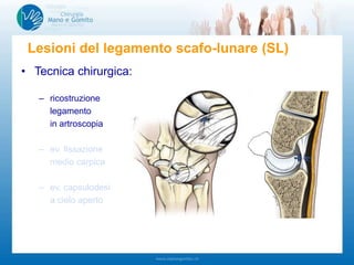 • Tecnica chirurgica:
– ricostruzione
legamento
in artroscopia
– ev. fissazione
medio carpica
– ev. capsulodesi
a cielo aperto
Lesioni del legamento scafo-lunare (SL)
 