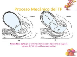 #
Proceso Mecánico del TP
Conducto de parto: (A) al término del embarazo y (B) durante el segundo
periodo del TdP (CR: anillo de contracción).
 