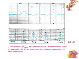 #
U Montevideo = (Pmáxima de cada contracción - Presión uterina basal)
en un espacio de 10 min y sumando las presiones generadas por
cada contraccion.
242 UM
 