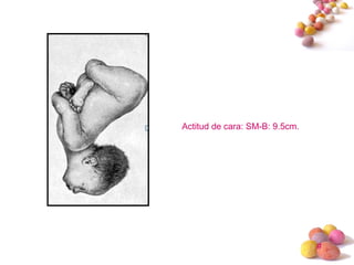 #
Actitud de cara: SM-B: 9.5cm.
 