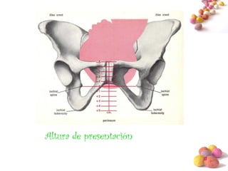 #
Altura de presentación
 
