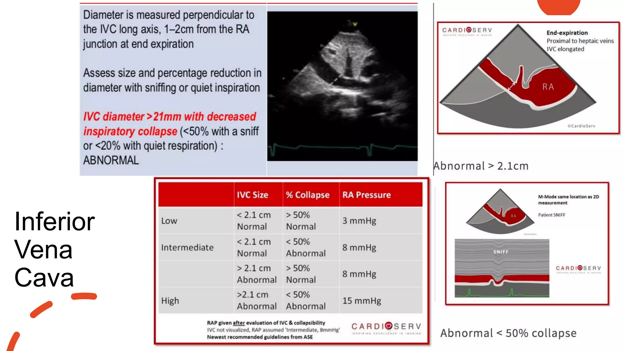 Inferior
Vena
Cava
 