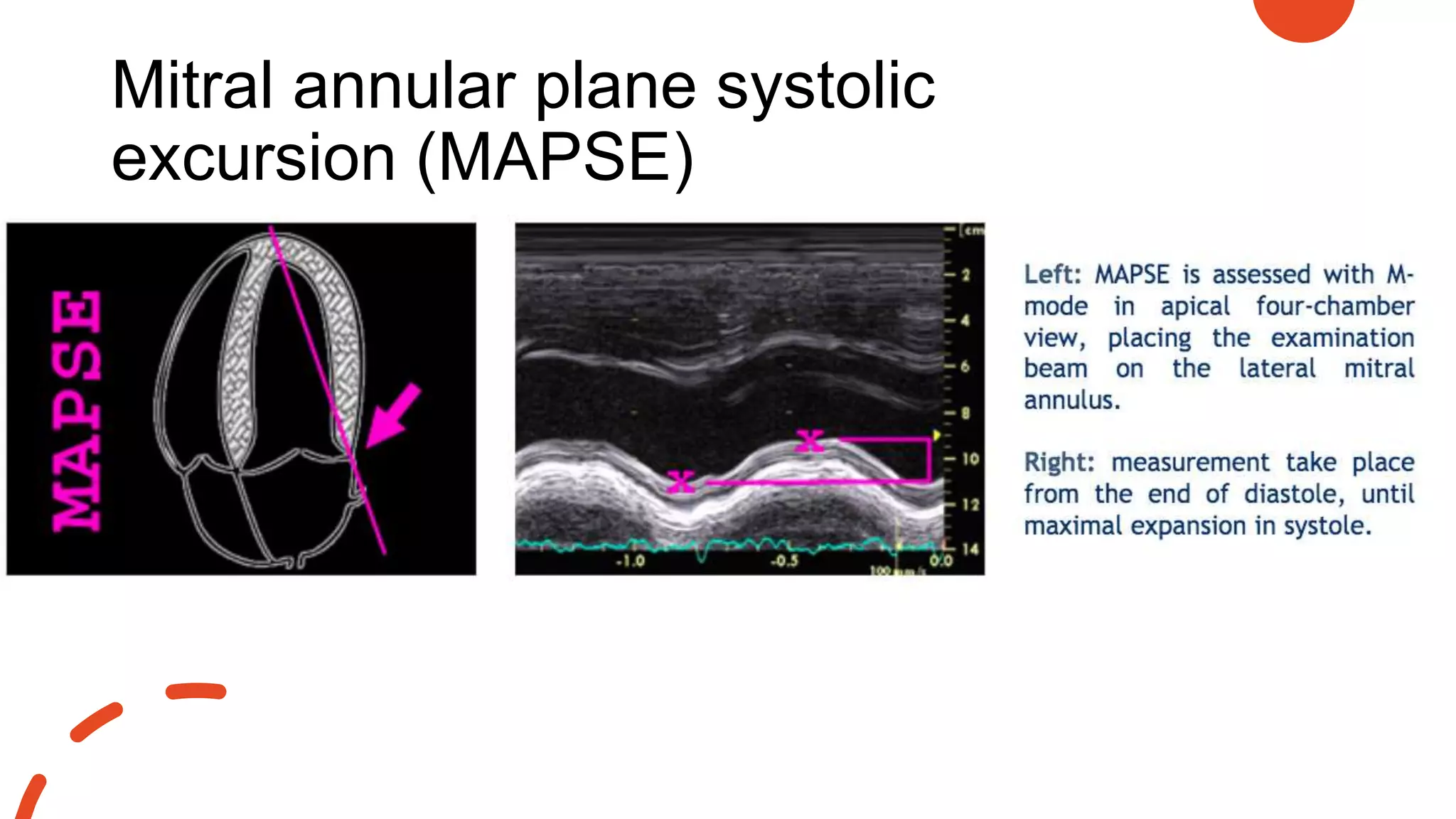 Mitral annular plane systolic
excursion (MAPSE)
• Tapse
• mapse
 