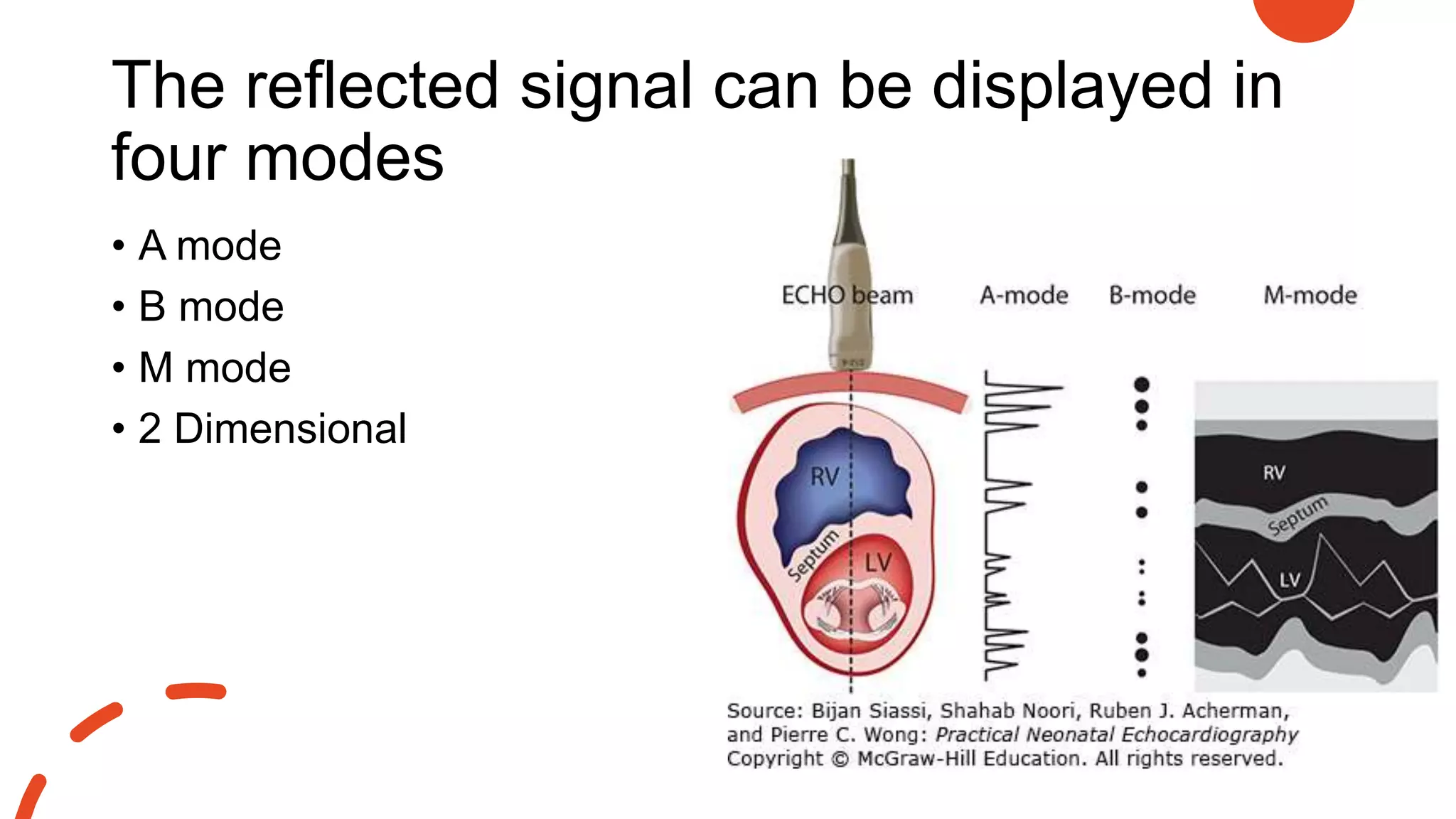The reflected signal can be displayed in
four modes
• A mode
• B mode
• M mode
• 2 Dimensional
 