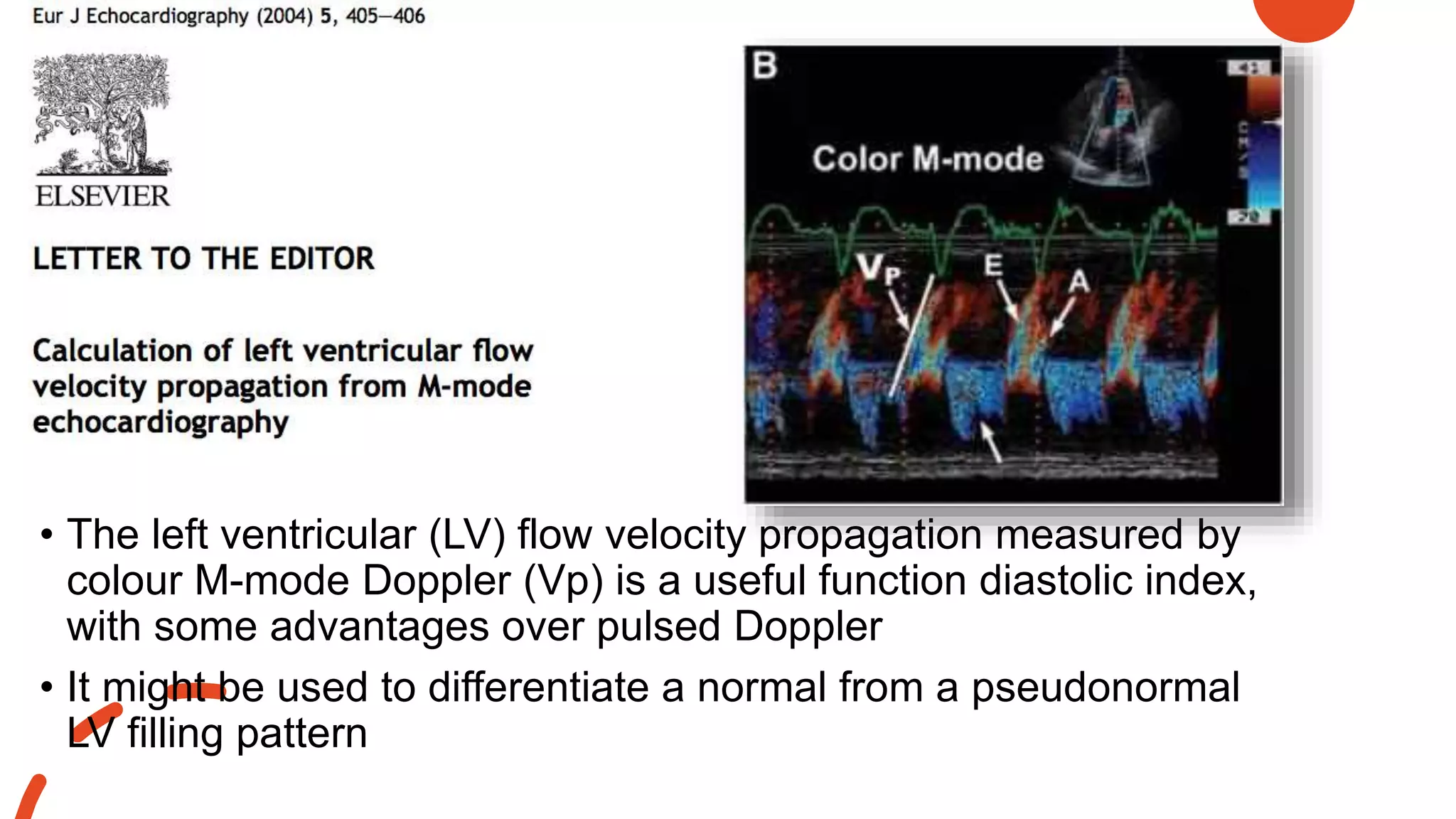 • The left ventricular (LV) flow velocity propagation measured by
colour M-mode Doppler (Vp) is a useful function diastolic index,
with some advantages over pulsed Doppler
• It might be used to differentiate a normal from a pseudonormal
LV filling pattern
 