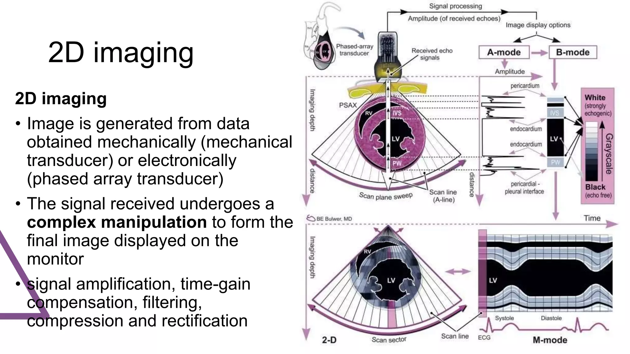2D imaging
2D imaging
• Image is generated from data
obtained mechanically (mechanical
transducer) or electronically
(phased array transducer)
• The signal received undergoes a
complex manipulation to form the
final image displayed on the
monitor
• signal amplification, time-gain
compensation, filtering,
compression and rectification
 