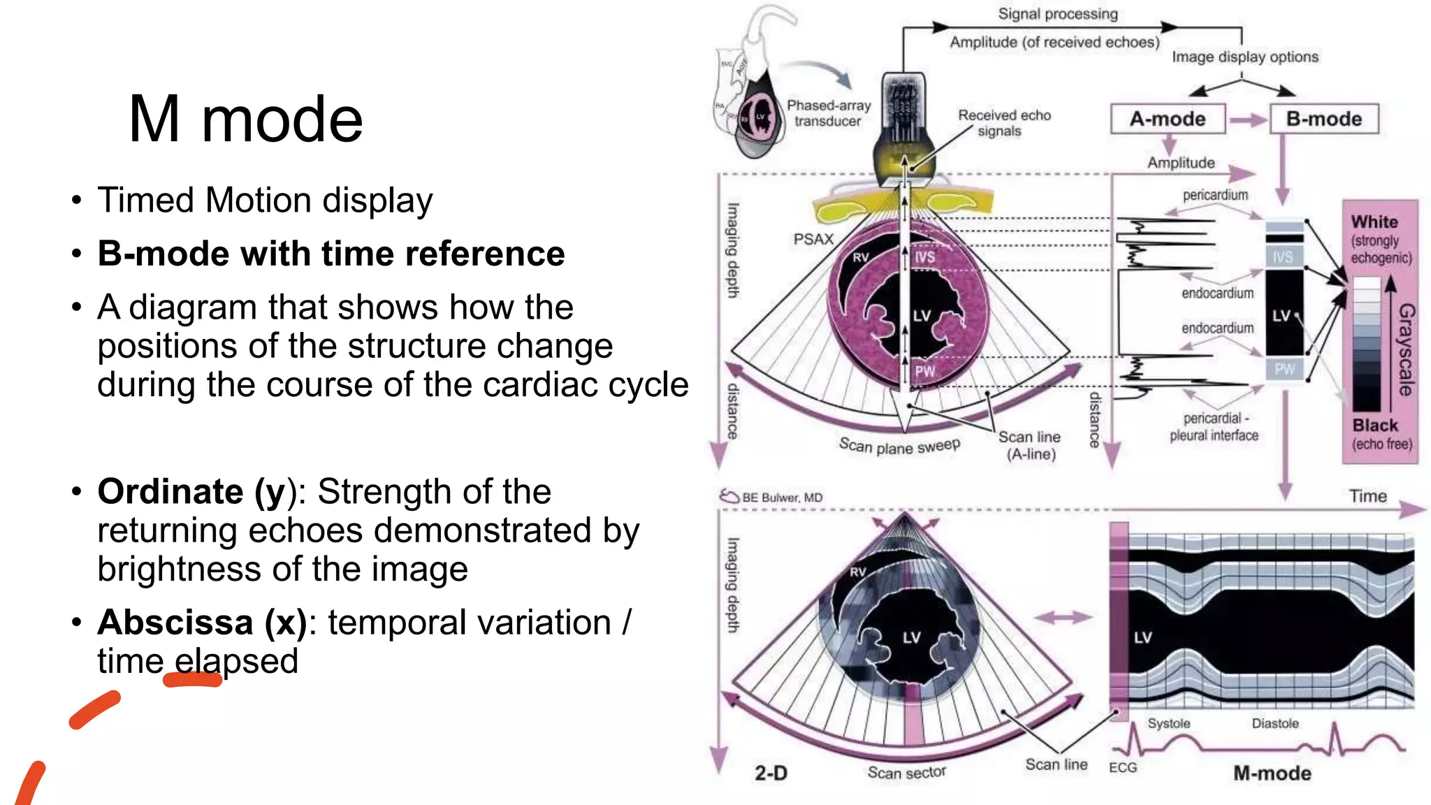 M mode
• Timed Motion display
• B-mode with time reference
• A diagram that shows how the
positions of the structure change
during the course of the cardiac cycle
• Ordinate (y): Strength of the
returning echoes demonstrated by
brightness of the image
• Abscissa (x): temporal variation /
time elapsed
 